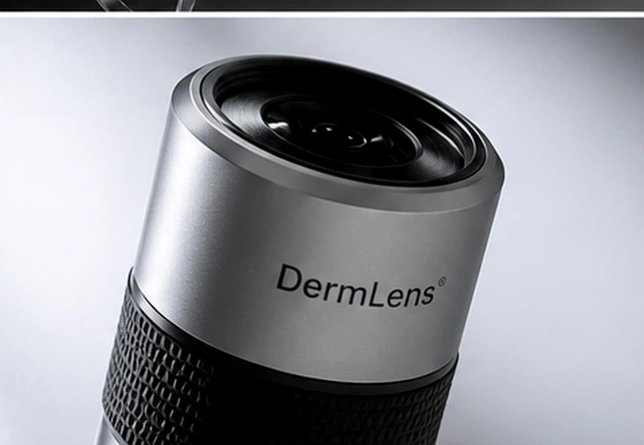 Dermoscopic capture example
