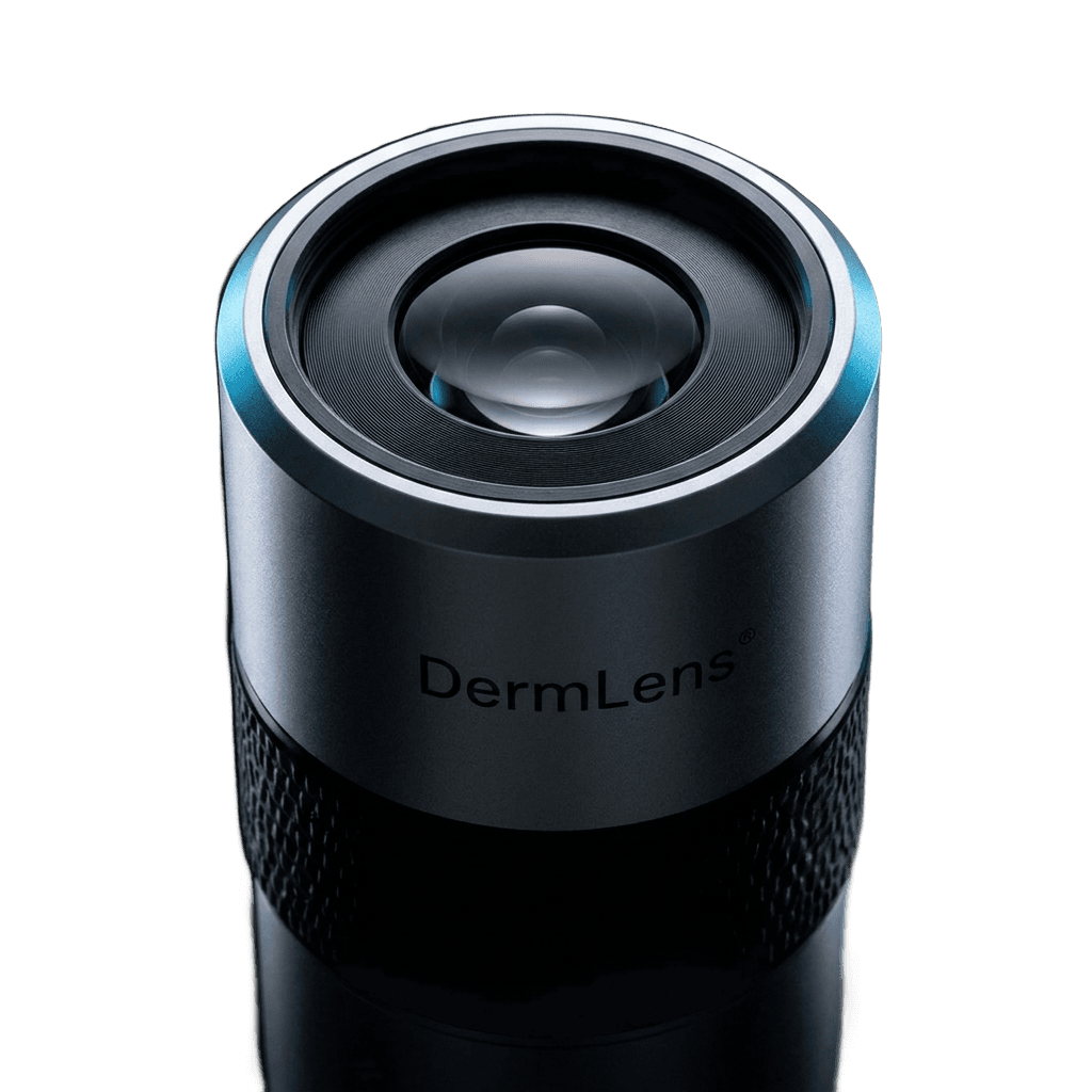 DermLens M6 optical system, lens-first view